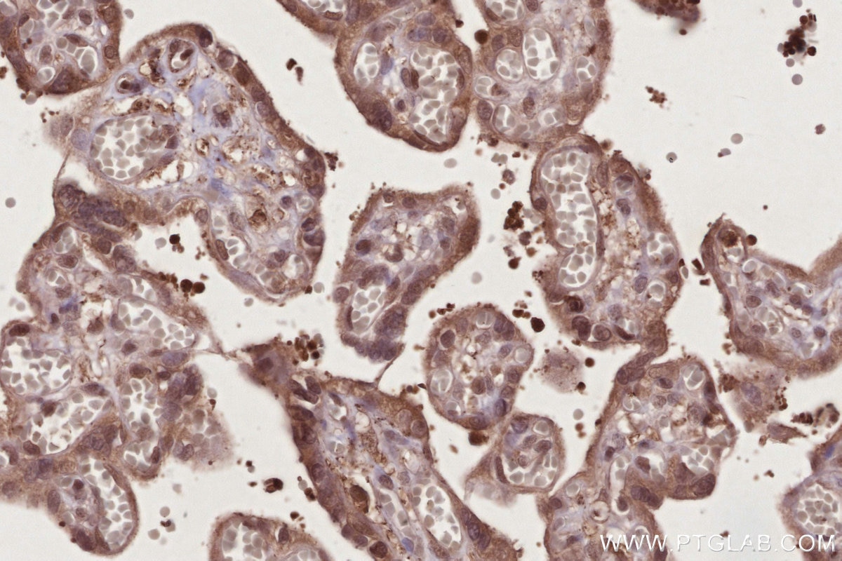 Immunohistochemistry (IHC) staining of human placenta tissue using NEK7 Polyclonal antibody (31422-1-AP)