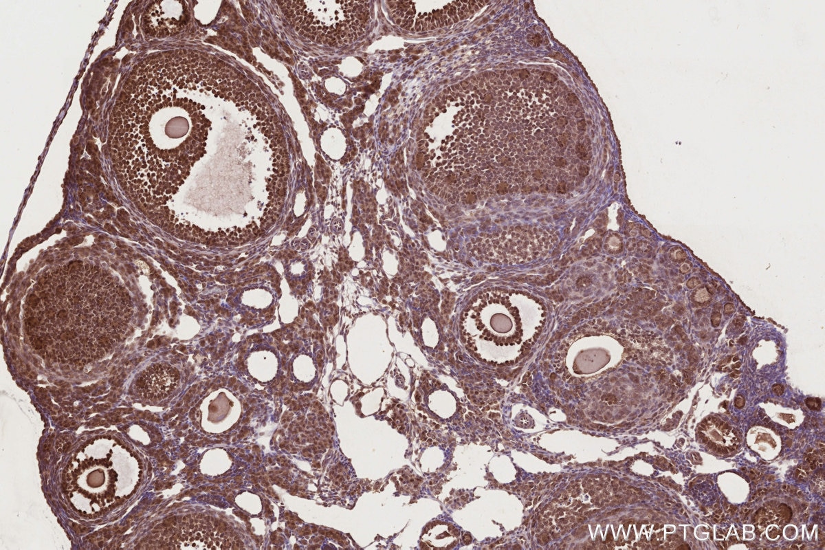 Immunohistochemistry (IHC) staining of mouse ovary tissue using NEK7 Polyclonal antibody (31422-1-AP)