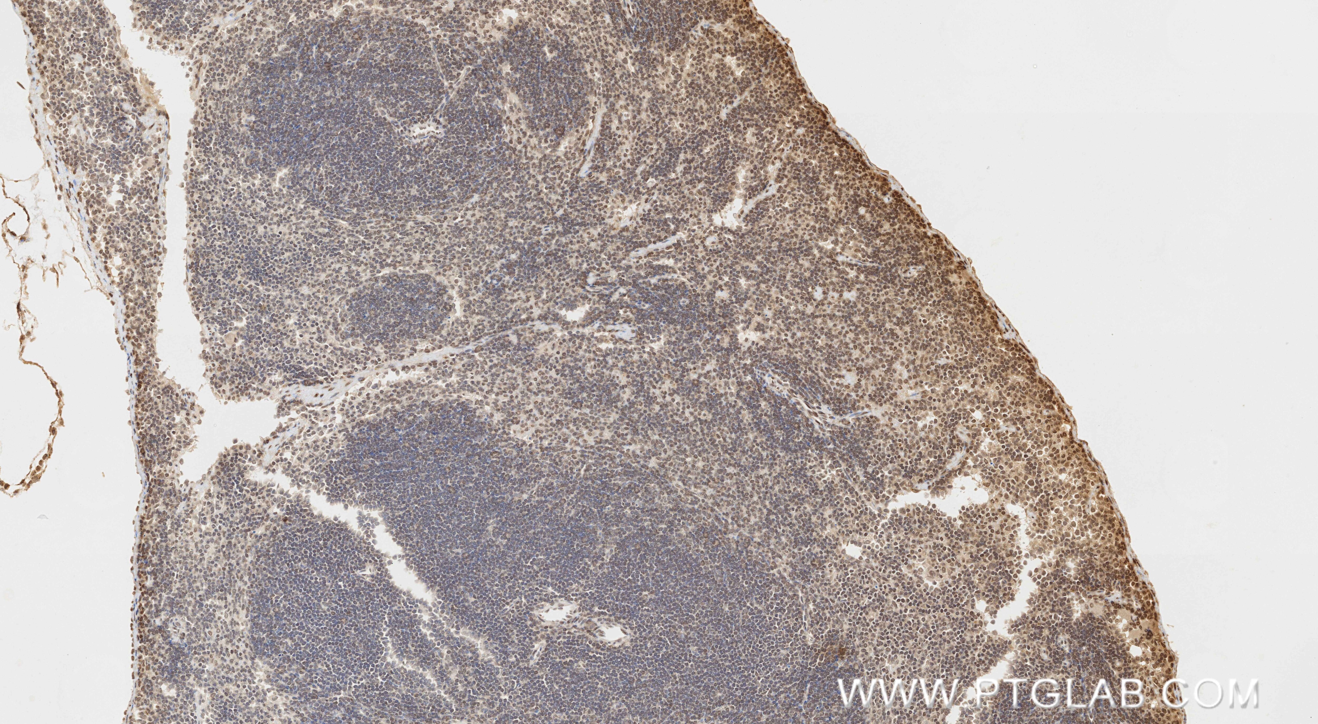 IHC staining of mouse spleen using 87253-1-RR Immunohistochemistry (IHC) staining of mouse spleen tissue using NEK7 Recombinant monoclonal antibody (87253-1-RR)