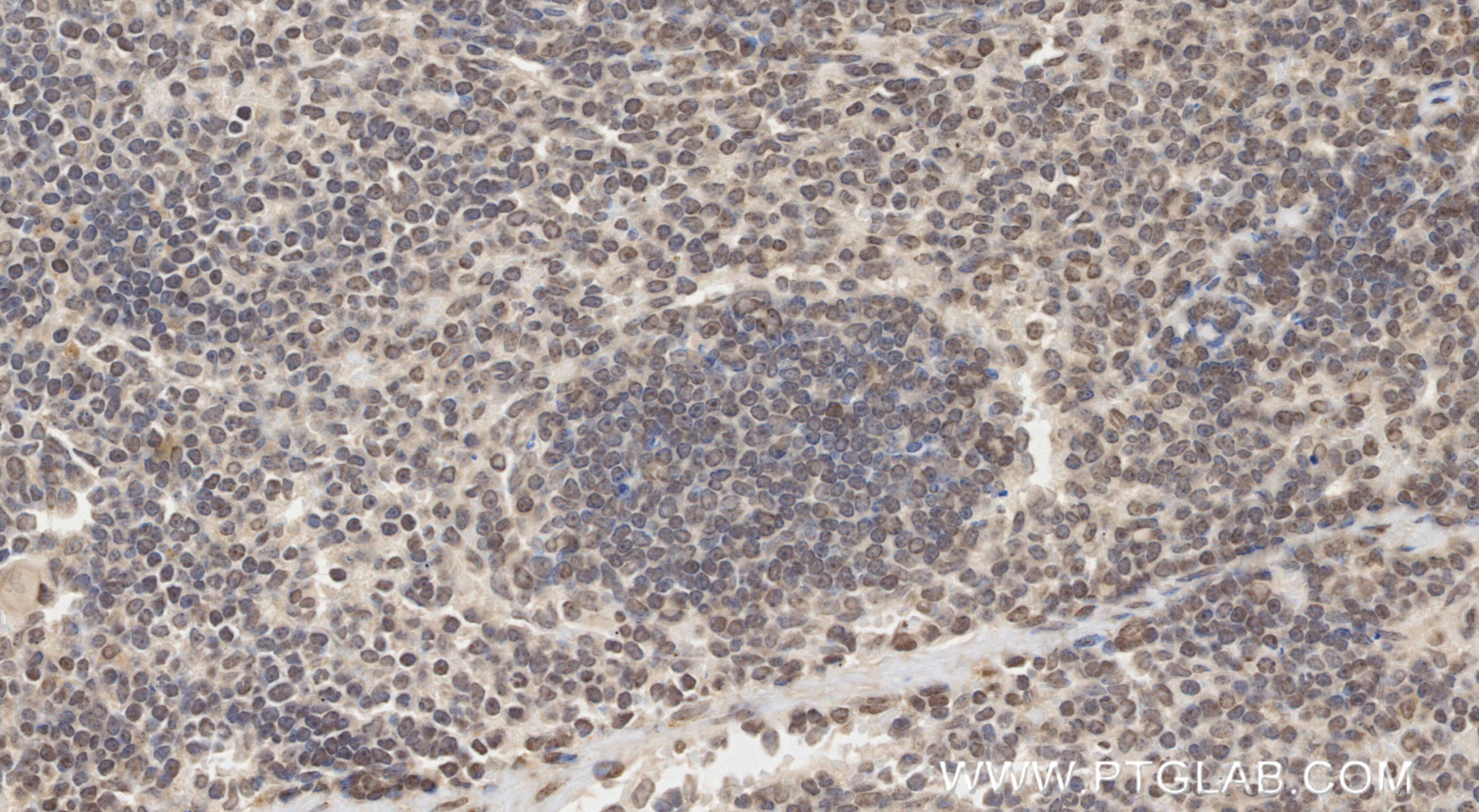 IHC staining of mouse spleen using 87253-1-RR Immunohistochemistry (IHC) staining of mouse spleen tissue using NEK7 Recombinant monoclonal antibody (87253-1-RR)