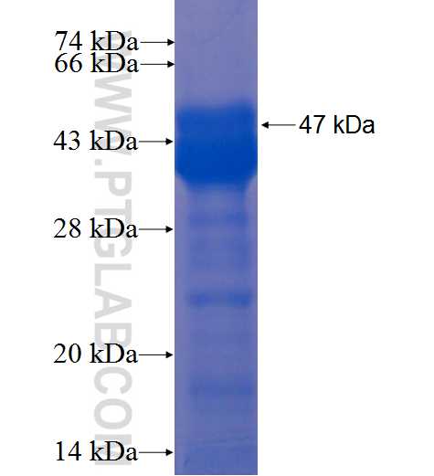 NEK8 fusion protein Ag22991 SDS-PAGE