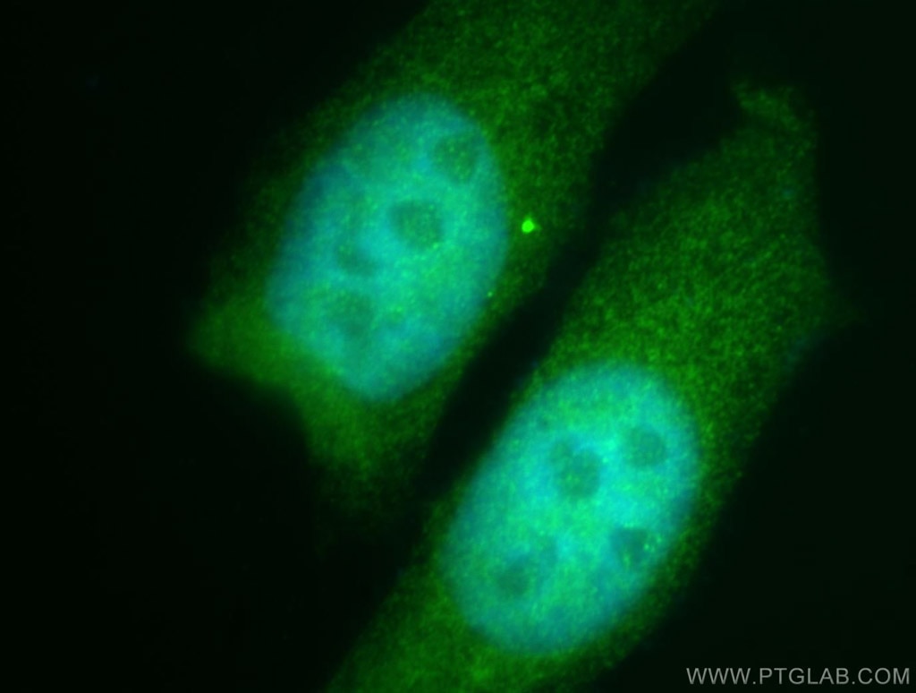 Immunofluorescence (IF) / fluorescent staining of HepG2 cells using NEK9 Polyclonal antibody (11192-1-AP)