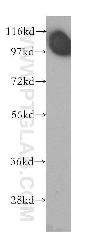 WB analysis of human placenta using 11192-1-AP