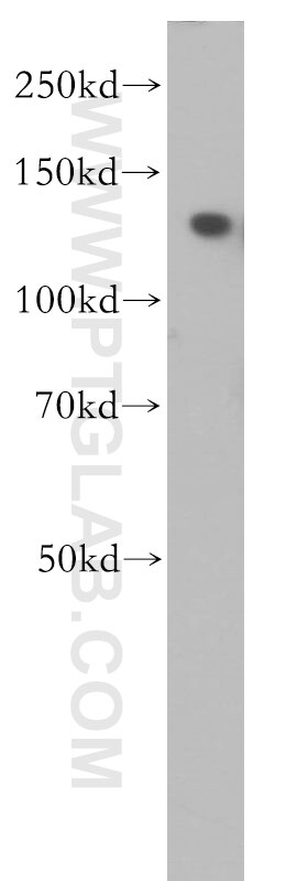 WB analysis of HeLa using 11192-1-AP