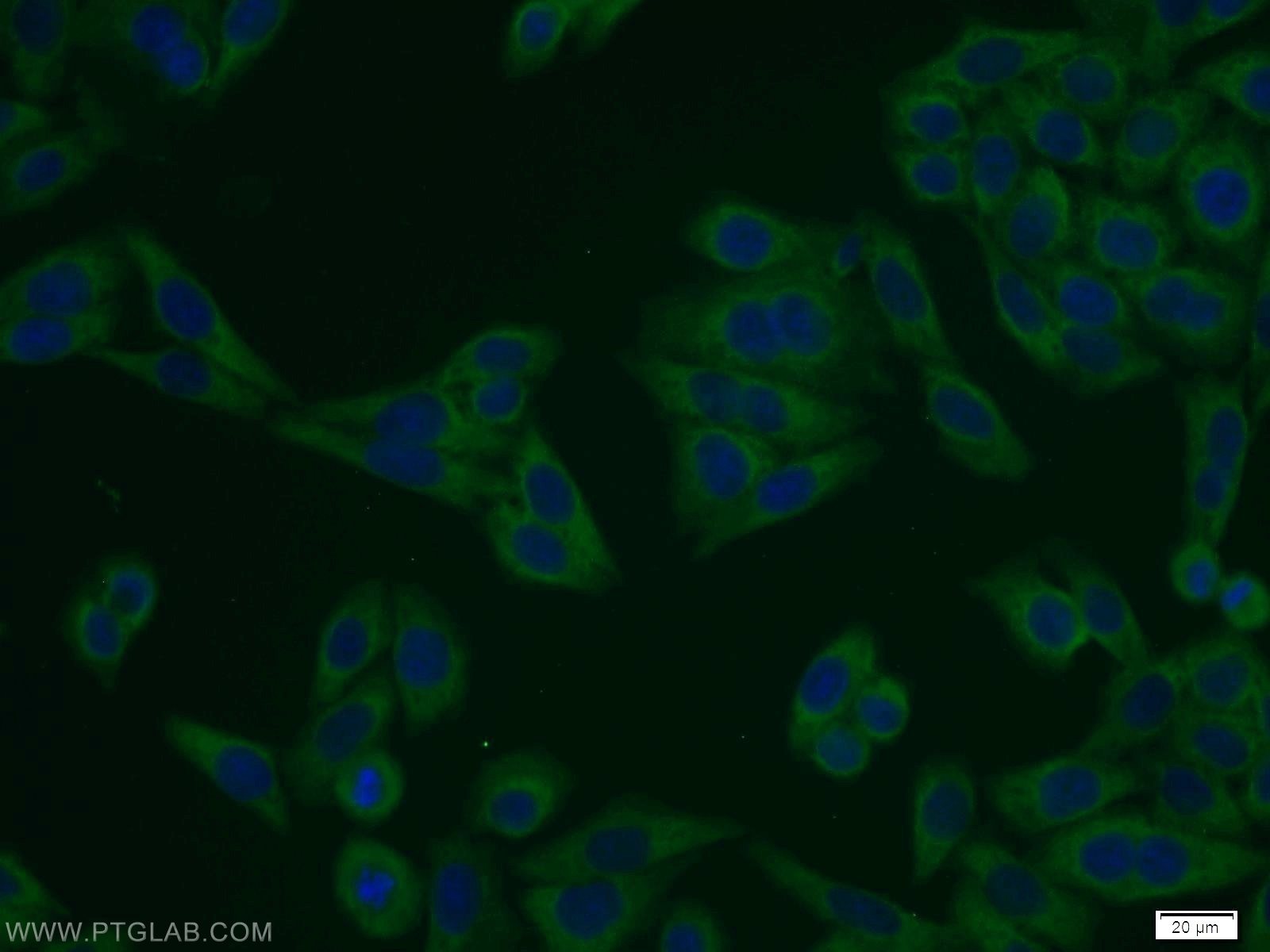 Immunofluorescence (IF) / fluorescent staining of HeLa cells using NELF-A Polyclonal antibody (10456-1-AP)