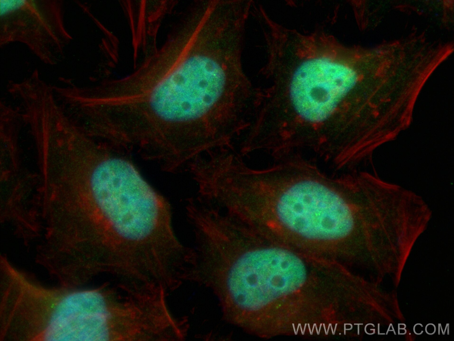 Immunofluorescence (IF) / fluorescent staining of HeLa cells using NELF-A Polyclonal antibody (10456-1-AP)