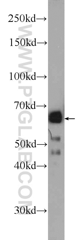 Western Blot (WB) analysis of HeLa cells using NELF-A Polyclonal antibody (10456-1-AP)