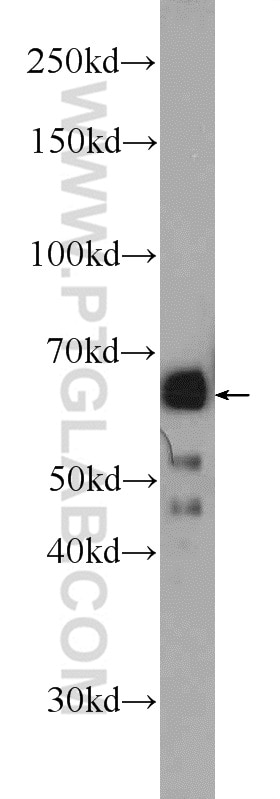 WB analysis of HeLa using 10456-1-AP