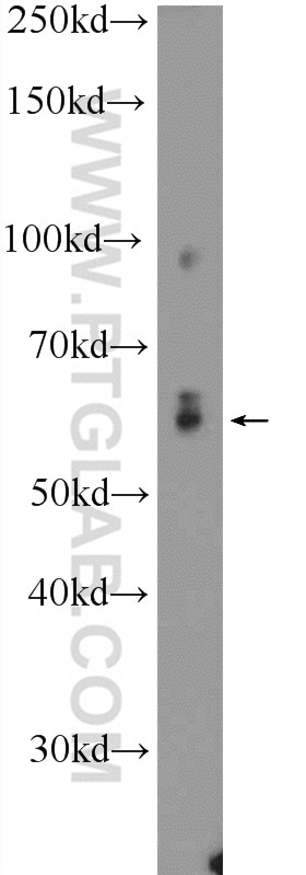 Western Blot (WB) analysis of mouse brain tissue using NELF-A Polyclonal antibody (10456-1-AP)