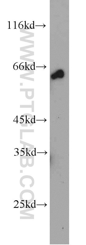 Western Blot (WB) analysis of HeLa cells using NELF-A Polyclonal antibody (10456-1-AP)