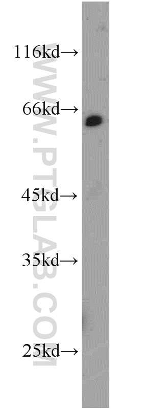 Western Blot (WB) analysis of mouse liver tissue using NELF-A Polyclonal antibody (10456-1-AP)