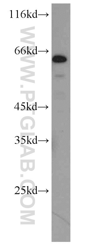 Western Blot (WB) analysis of Jurkat cells using NELF-A Polyclonal antibody (10456-1-AP)