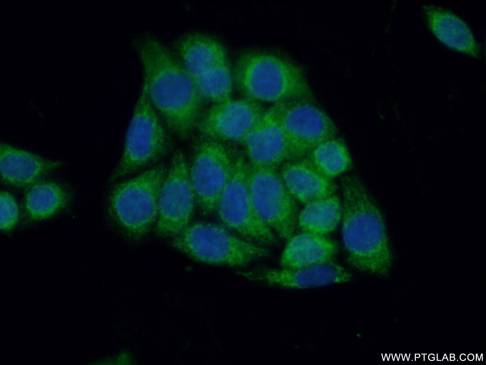 Immunofluorescence (IF) / fluorescent staining of HeLa cells using NELF Polyclonal antibody (12244-1-AP)