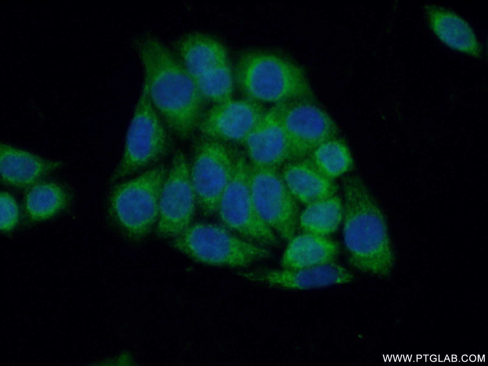 IF Staining of HeLa using 12244-1-AP