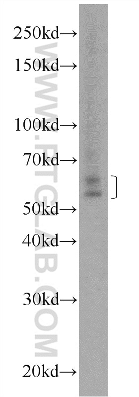 Western Blot (WB) analysis of mouse testis tissue using NELF Polyclonal antibody (12244-1-AP)