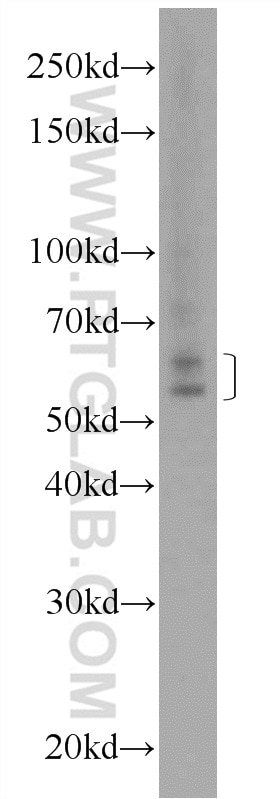 WB analysis of mouse testis using 12244-1-AP