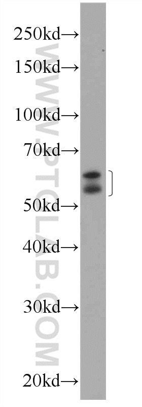 Western Blot (WB) analysis of HeLa cells using NELF Polyclonal antibody (12244-1-AP)