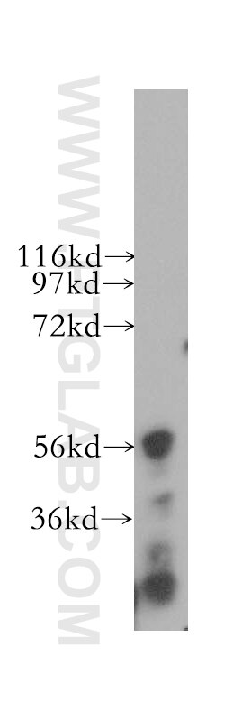 Western Blot (WB) analysis of human brain tissue using NELF Polyclonal antibody (12244-1-AP)