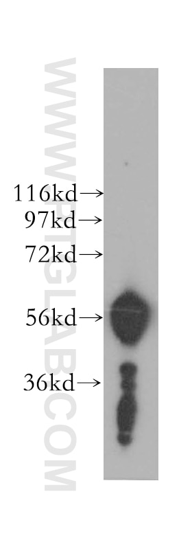 Western Blot (WB) analysis of human colon tissue using NELF Polyclonal antibody (12244-1-AP)
