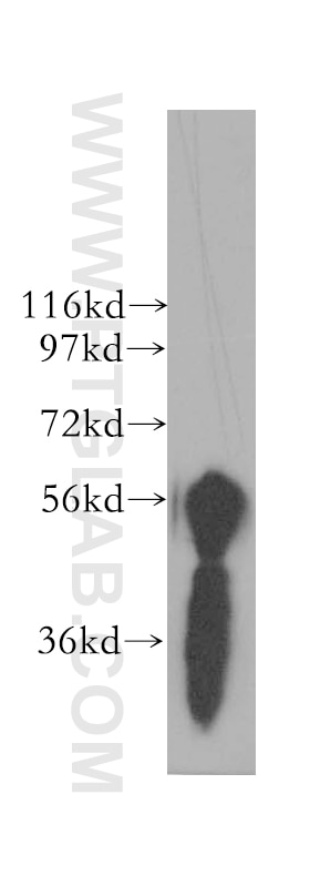 Western Blot (WB) analysis of HeLa cells using NELF Polyclonal antibody (12244-1-AP)