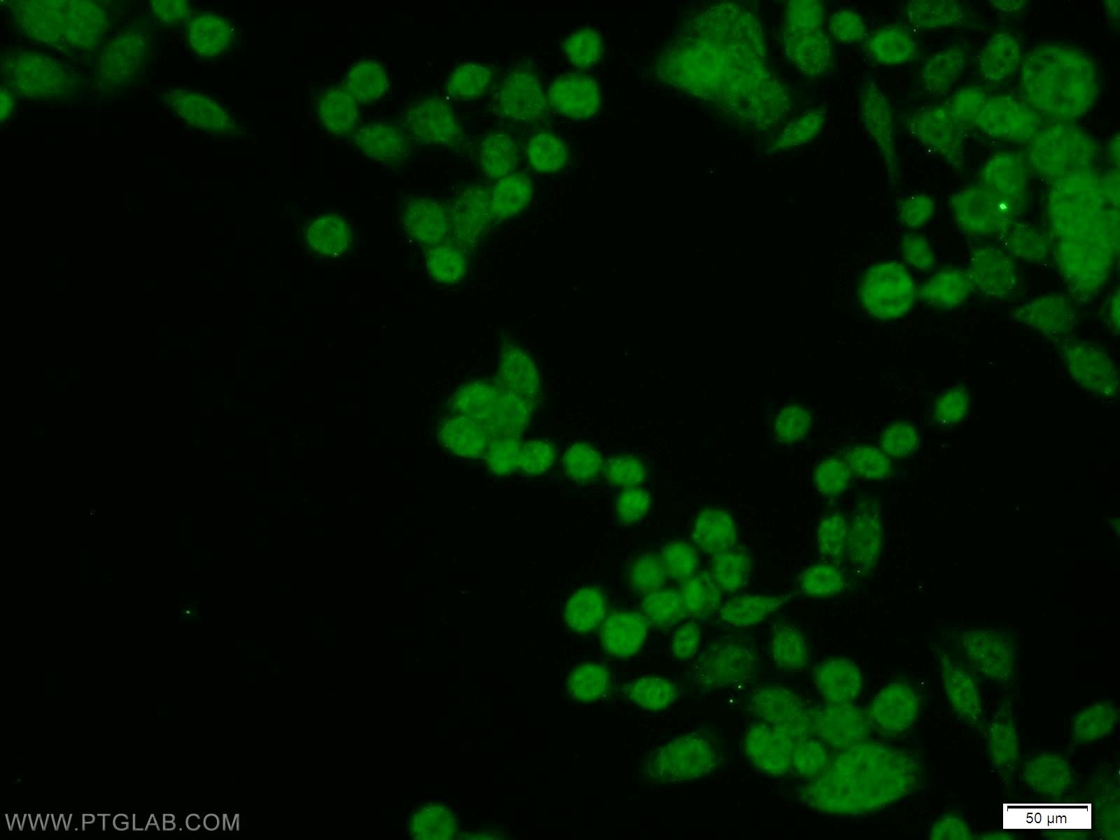 Immunofluorescence (IF) / fluorescent staining of BxPC-3 cells using NELFB Polyclonal antibody (16418-1-AP)