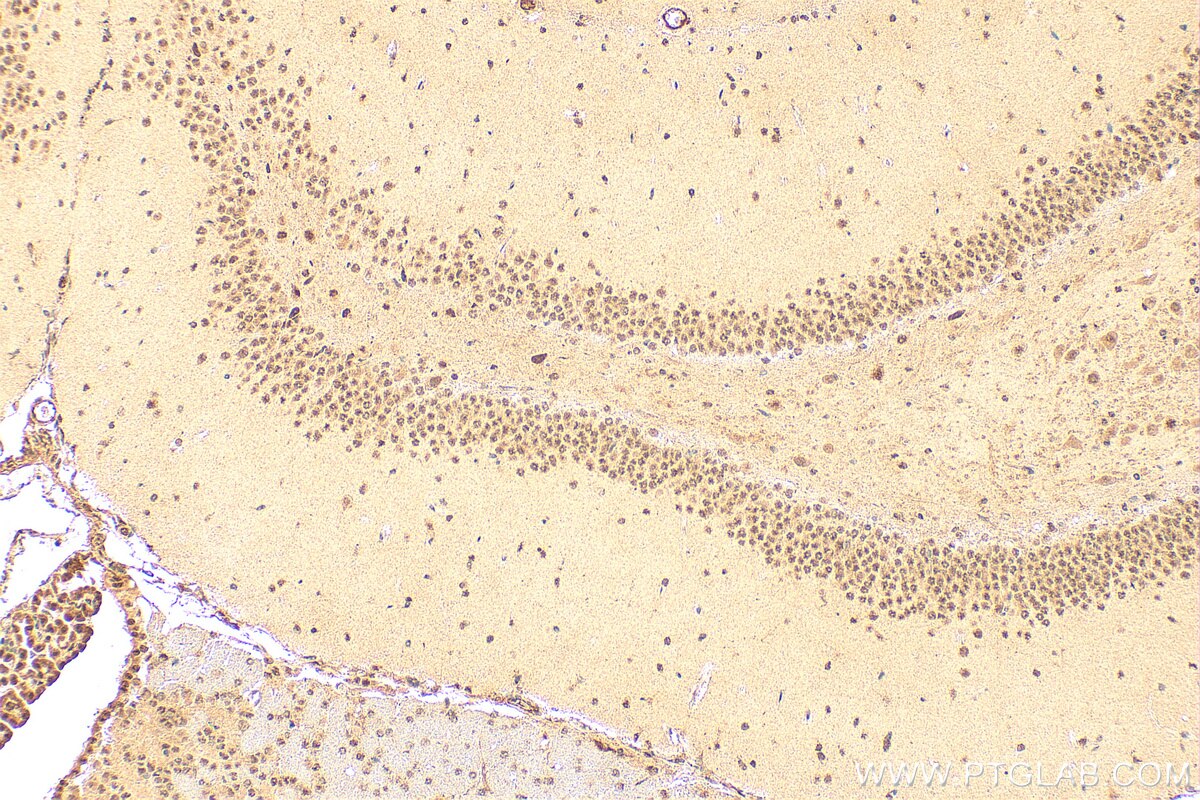 Immunohistochemical analysis of paraffin-embedded rat brain tissue slide using 16418-1-AP (NELFB antibody) at dilution of 1:200 (under 10x lens). Heat mediated antigen retrieval with Tris-EDTA buffer (pH 9.0). Immunohistochemistry (IHC) staining of rat brain tissue using NELFB Polyclonal antibody (16418-1-AP)