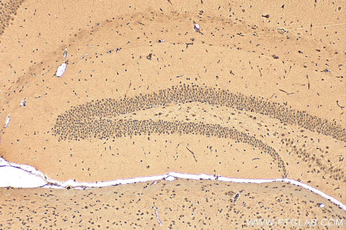 Immunohistochemical analysis of paraffin-embedded mouse brain tissue slide using 16418-1-AP (NELFB antibody) at dilution of 1:200 (under 10x lens). Heat mediated antigen retrieval with Tris-EDTA buffer (pH 9.0). Immunohistochemistry (IHC) staining of mouse brain tissue using NELFB Polyclonal antibody (16418-1-AP)