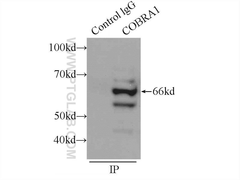 Immunoprecipitation (IP) experiment of mouse brain tissue using NELFB Polyclonal antibody (16418-1-AP)