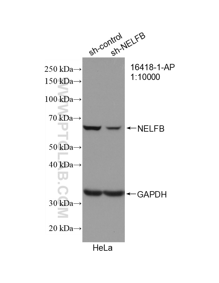 Western Blot (WB) analysis of HeLa cells using NELFB Polyclonal antibody (16418-1-AP)