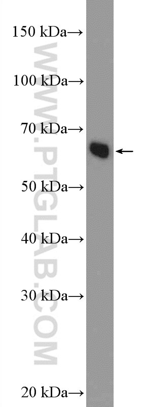 Western Blot (WB) analysis of BxPC-3 cells using NELFB Polyclonal antibody (16418-1-AP)