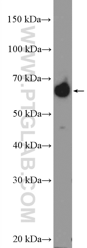 Western Blot (WB) analysis of BxPC-3 cells using NELFB Polyclonal antibody (16418-1-AP)