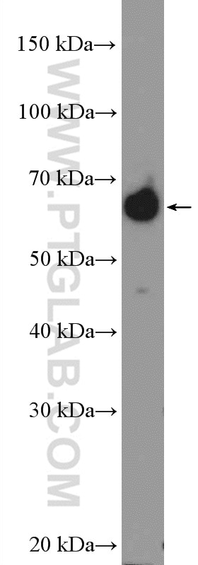 WB analysis of BxPC-3 using 16418-1-AP