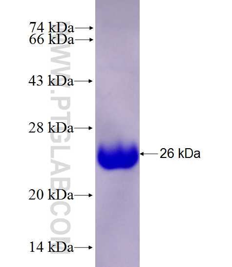 NELL1 fusion protein Ag27773 SDS-PAGE