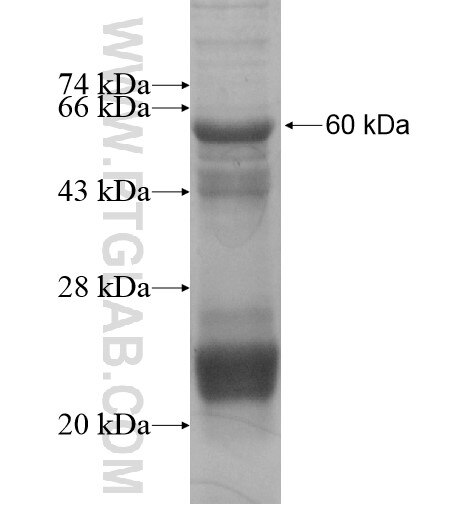 NELL1 fusion protein Ag15602 SDS-PAGE