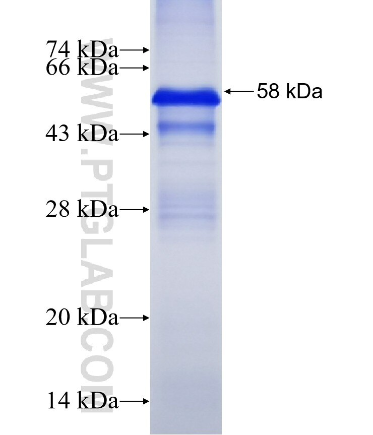 NELL1 fusion protein Ag15602 SDS-PAGE