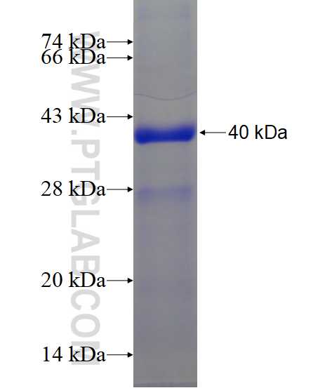 NELL1 fusion protein Ag16542 SDS-PAGE