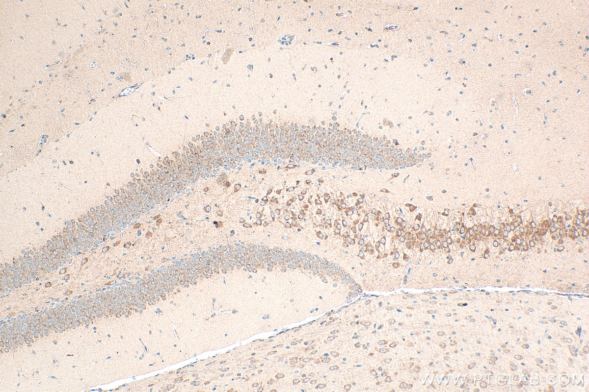 Immunohistochemical analysis of paraffin-embedded mouse brain tissue slide using 11268-1-AP (NELL2 antibody) at dilution of 1:500 (under 10x lens). Heat mediated antigen retrieval with Tris-EDTA buffer (pH 9.0). Immunohistochemistry (IHC) staining of mouse brain tissue using NELL2 Polyclonal antibody (11268-1-AP)