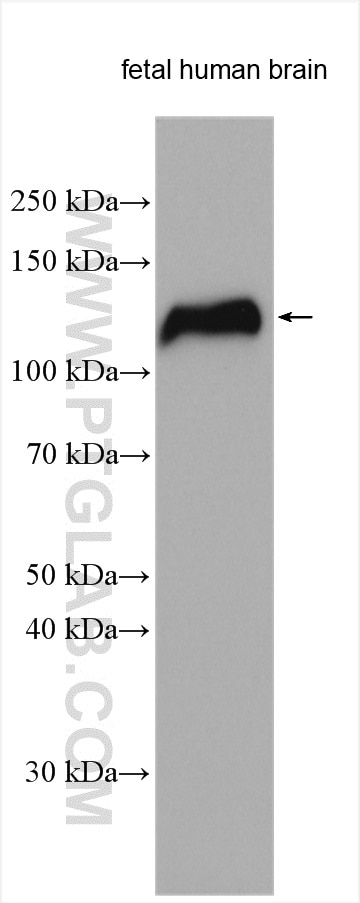 Western Blot (WB) analysis of various lysates using NELL2 Polyclonal antibody (11268-1-AP)