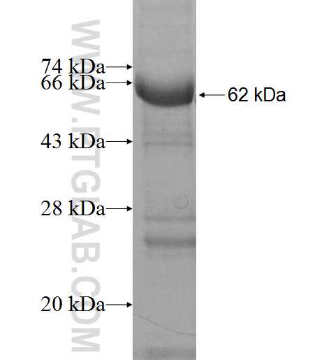 NELL2 fusion protein Ag1793 SDS-PAGE