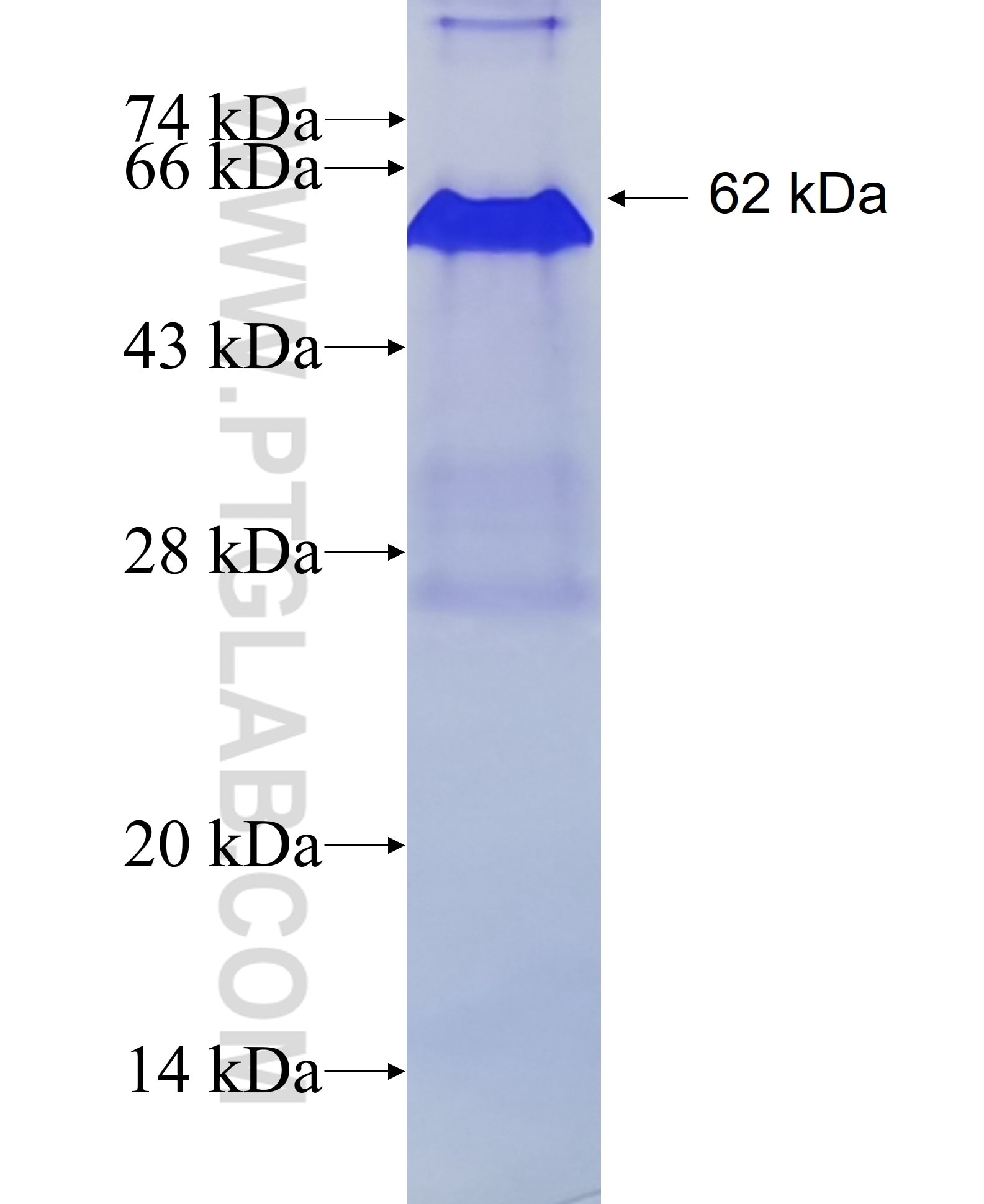 NELL2 fusion protein Ag1793 SDS-PAGE