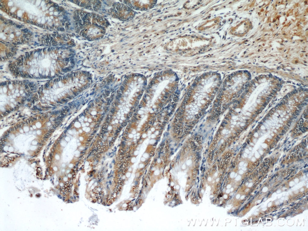 Immunohistochemistry (IHC) staining of human colon tissue using Neudesin/NENF Monoclonal antibody (60131-1-Ig)