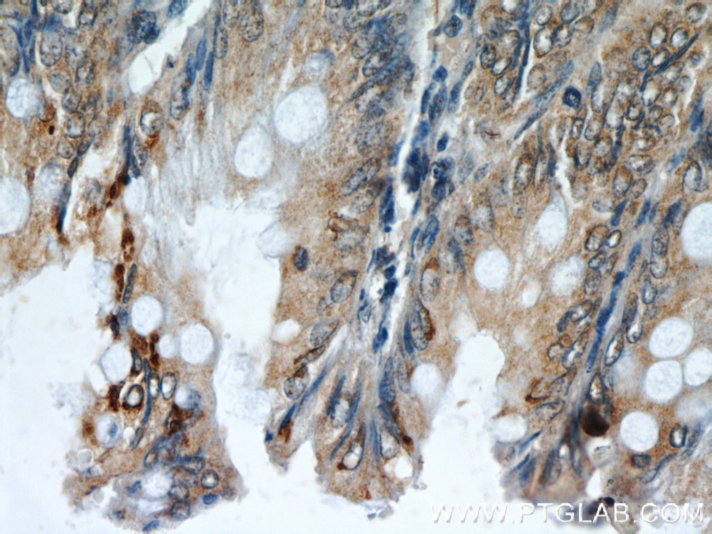Immunohistochemistry (IHC) staining of human colon tissue using Neudesin/NENF Monoclonal antibody (60131-1-Ig)