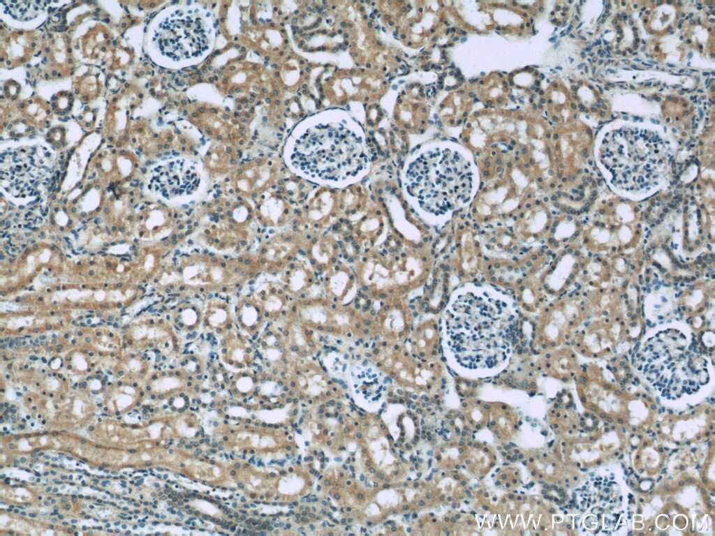 IHC staining of human kidney using 60131-1-Ig