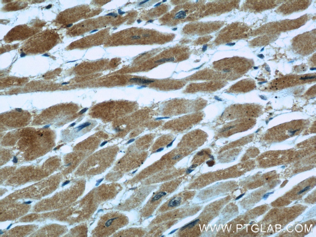 IHC staining of human heart using 60131-1-Ig