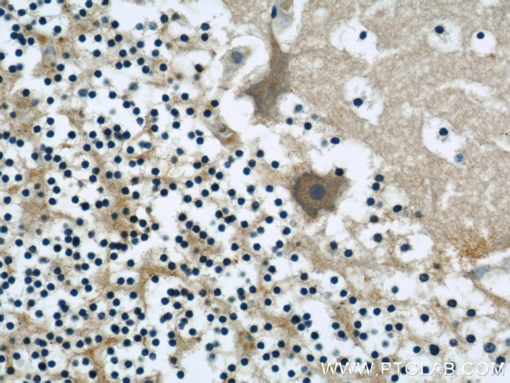 IHC staining of human cerebellum using 60131-1-Ig