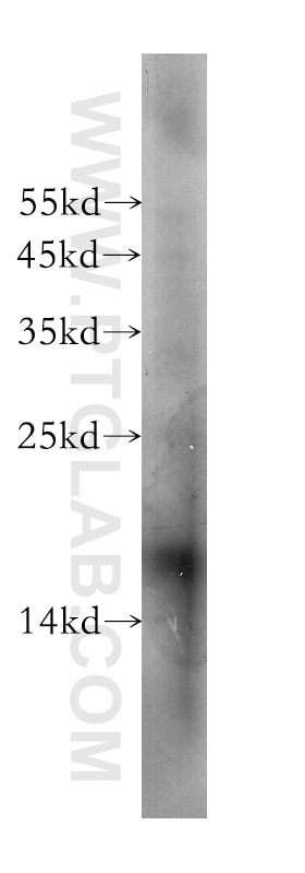 Neudesin/NENF antibody (60131-1-Ig) | Proteintech