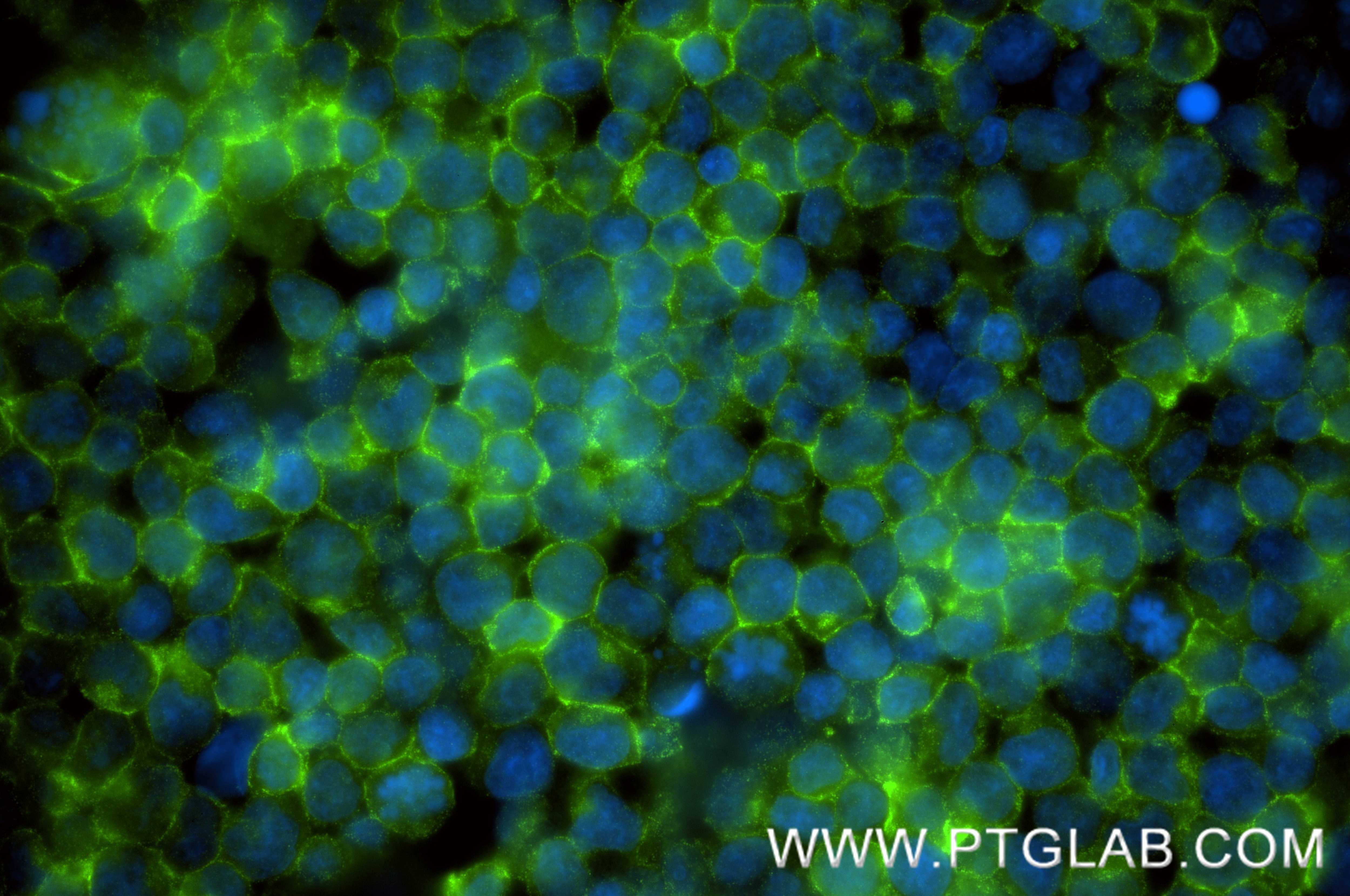 IF Staining of Jurkat using 88292-1-RR (same clone as 88292-1-PBS) Immunofluorescence (IF) / fluorescent staining of Jurkat cells using Neogenin Recombinant monoclonal antibody (88292-1-RR)