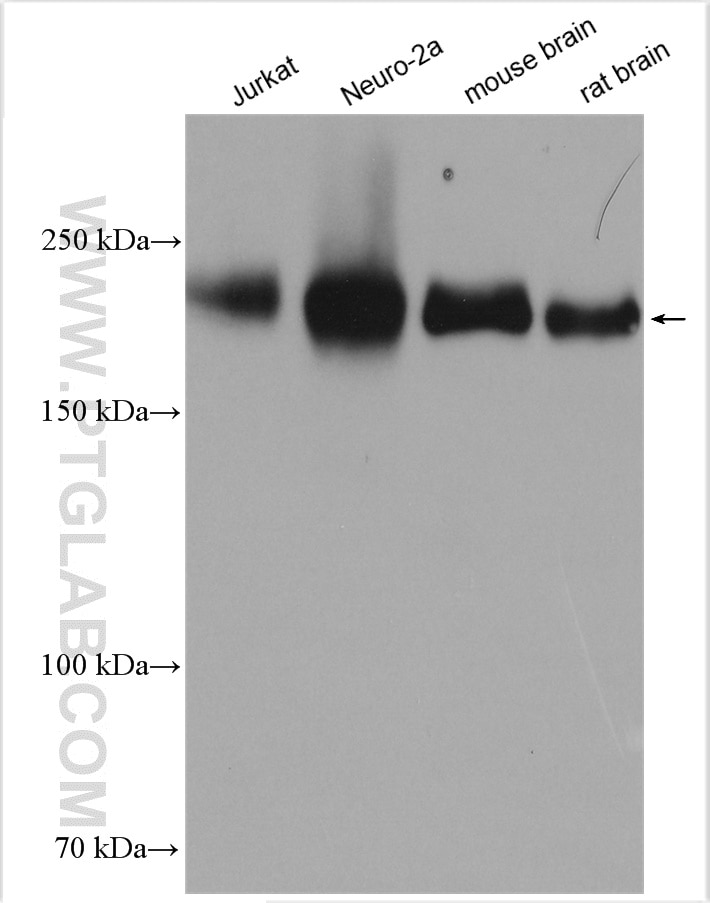 Western Blot (WB) analysis of various lysates using Neogenin-Specific Polyclonal antibody (20246-1-AP)