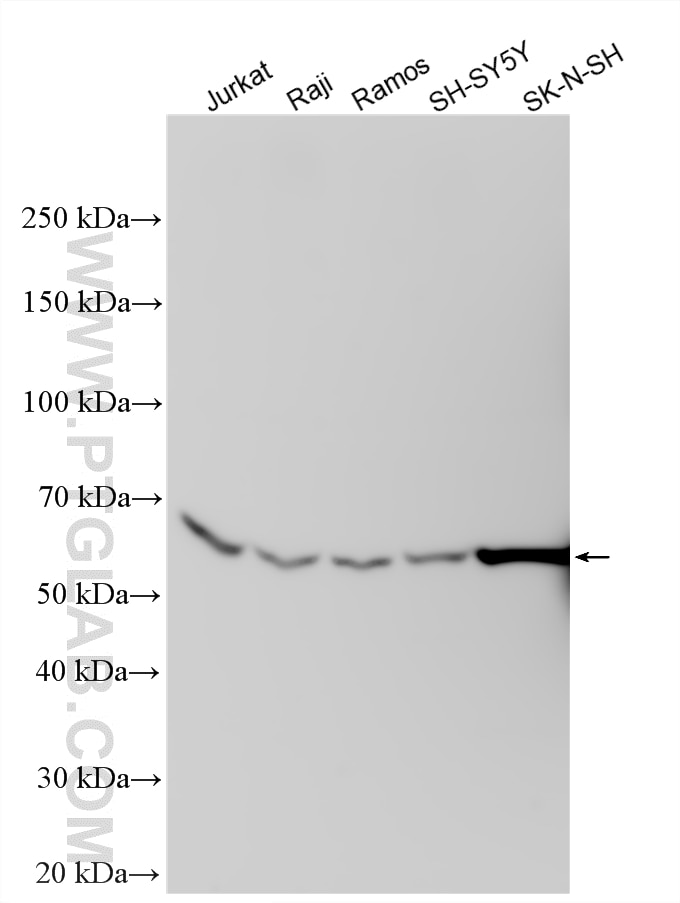 Western Blot (WB) analysis of various lysates using NEPRO Polyclonal antibody (33450-1-AP)