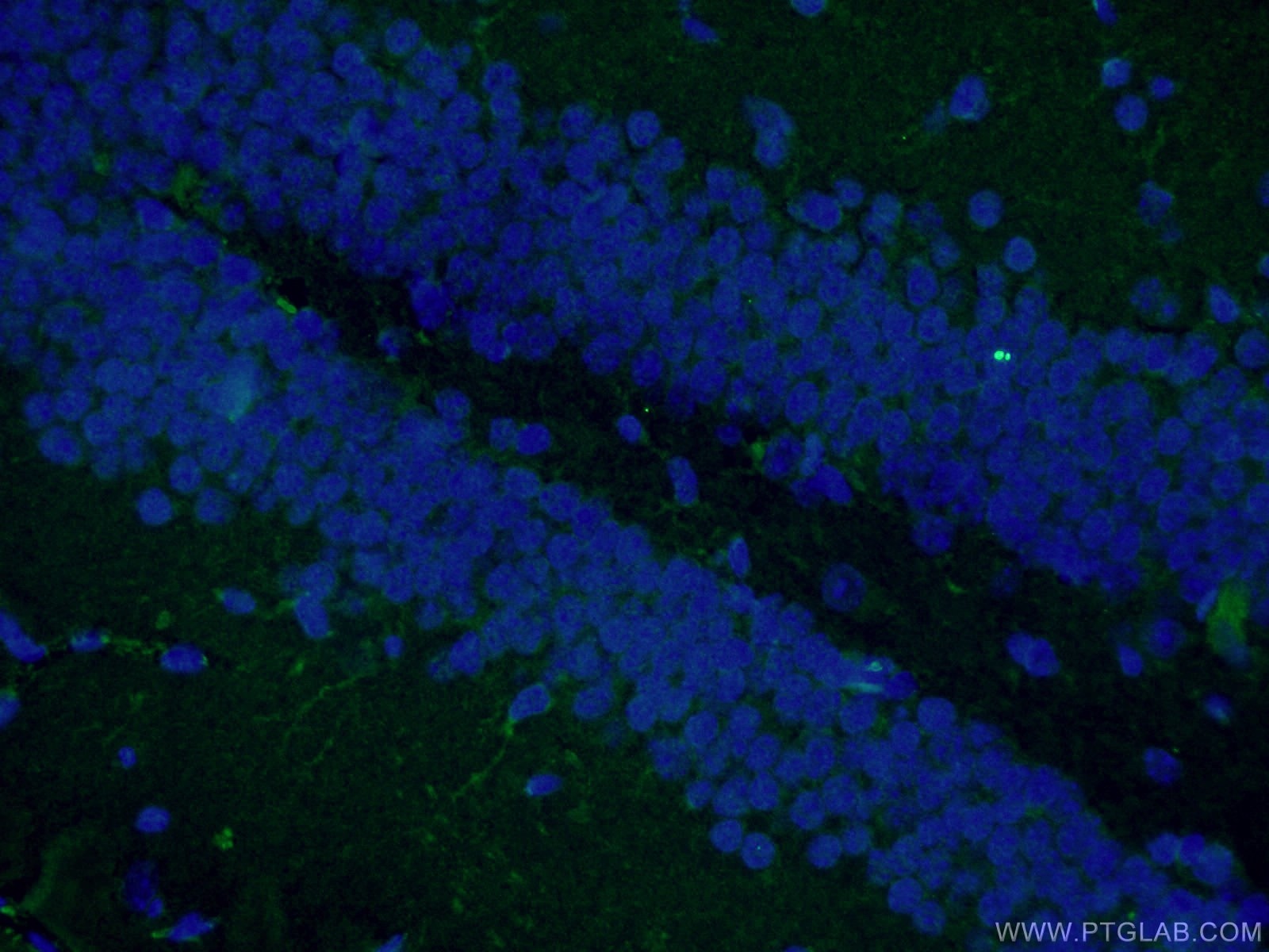 Immunofluorescence (IF) / fluorescent staining of mouse brain tissue using Nestin Polyclonal antibody (19483-1-AP)